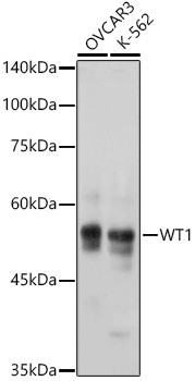 WT1 Antibody in Western Blot (WB)