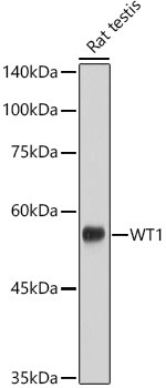 WT1 Antibody in Western Blot (WB)