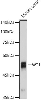 WT1 Antibody in Western Blot (WB)