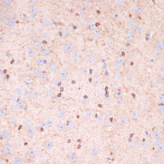 Gelsolin Antibody in Immunohistochemistry (Paraffin) (IHC (P))