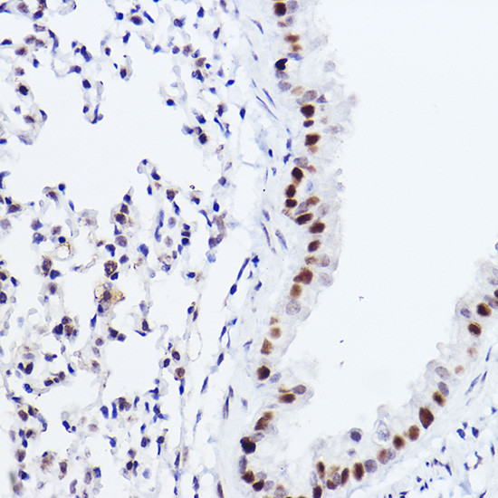 p73 Antibody in Immunohistochemistry (Paraffin) (IHC (P))