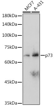 p73 Antibody in Western Blot (WB)