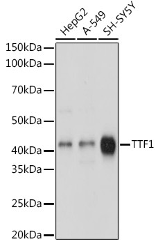 Nkx2.1 Antibody in Western Blot (WB)