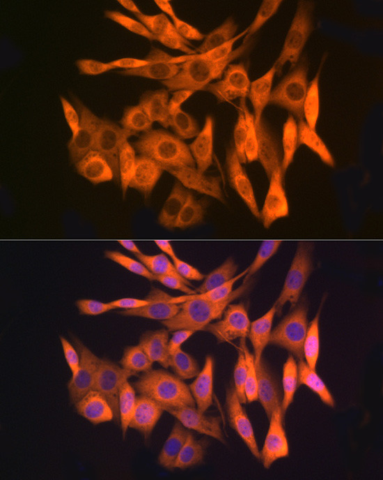 GLI3 Antibody in Immunocytochemistry (ICC/IF)