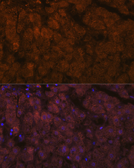 ADAMTS13 Antibody in Immunohistochemistry (Paraffin) (IHC (P))