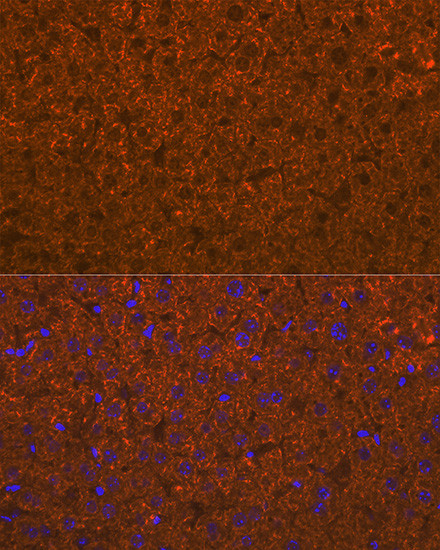 ADAMTS13 Antibody in Immunohistochemistry (Paraffin) (IHC (P))