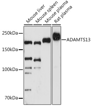 ADAMTS13 Antibody in Western Blot (WB)