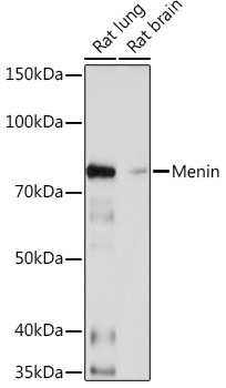 Menin Antibody in Western Blot (WB)