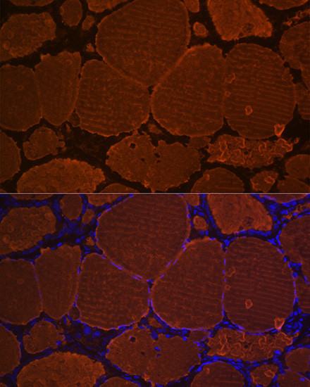 Thyroglobulin Antibody in Immunohistochemistry (Paraffin) (IHC (P))