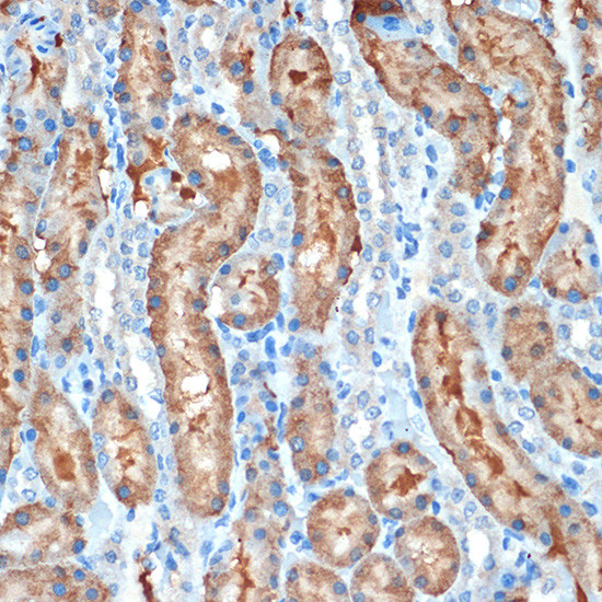 MUC4 Antibody in Immunohistochemistry (Paraffin) (IHC (P))