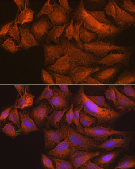 TBK1 Antibody in Immunocytochemistry (ICC/IF)