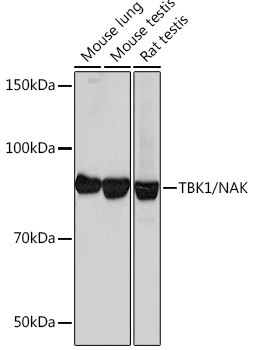 TBK1 Antibody in Western Blot (WB)