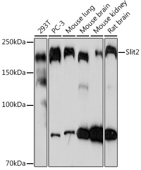 SLIT2 Antibody in Western Blot (WB)