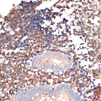 EHD1 Antibody in Immunohistochemistry (Paraffin) (IHC (P))