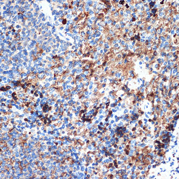 CRMP5 Antibody in Immunohistochemistry (Paraffin) (IHC (P))