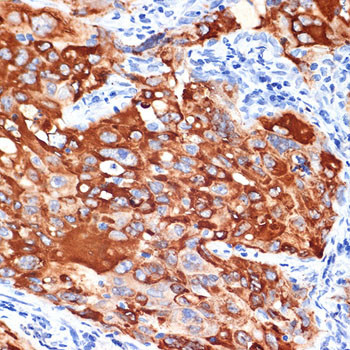 IL13RA1 Antibody in Immunohistochemistry (Paraffin) (IHC (P))