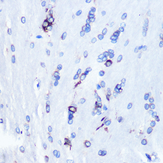 YBX1 Antibody in Immunohistochemistry (Paraffin) (IHC (P))