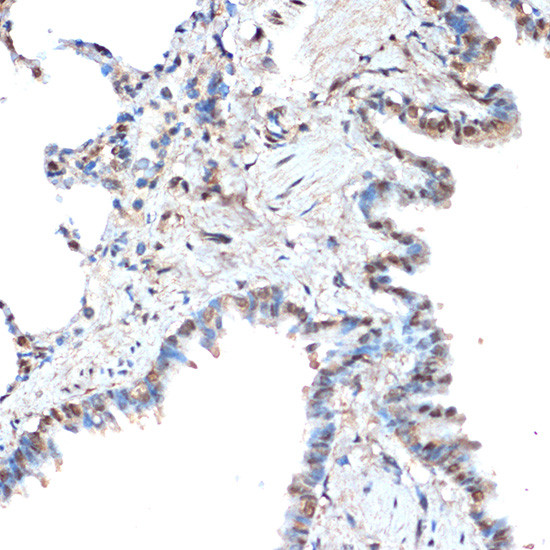 RCOR1 Antibody in Immunohistochemistry (Paraffin) (IHC (P))