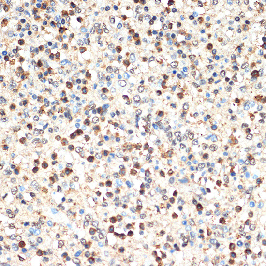 SHIP1 Antibody in Immunohistochemistry (Paraffin) (IHC (P))