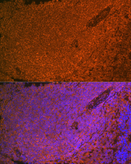 SHIP1 Antibody in Immunohistochemistry (Paraffin) (IHC (P))