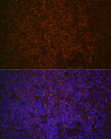 SHIP1 Antibody in Immunohistochemistry (Paraffin) (IHC (P))