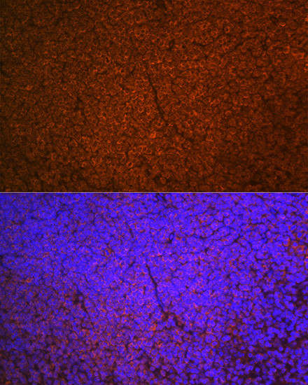 SHIP1 Antibody in Immunohistochemistry (Paraffin) (IHC (P))