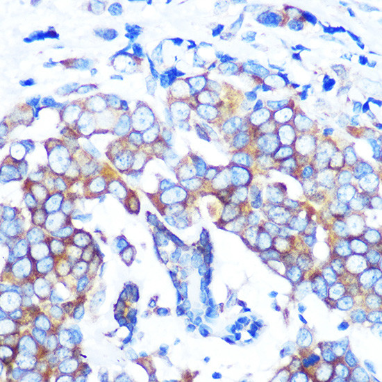 HDAC6 Antibody in Immunohistochemistry (Paraffin) (IHC (P))