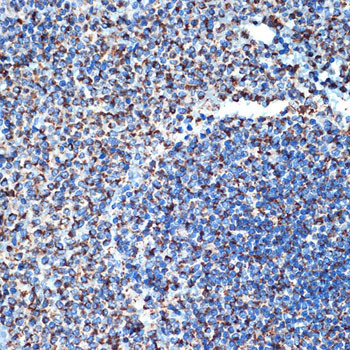 CD264 (TRAIL-R4) Antibody in Immunohistochemistry (Paraffin) (IHC (P))