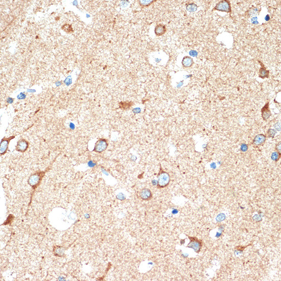 CD264 (TRAIL-R4) Antibody in Immunohistochemistry (Paraffin) (IHC (P))