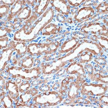 CD264 (TRAIL-R4) Antibody in Immunohistochemistry (Paraffin) (IHC (P))