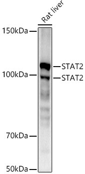 STAT2 Antibody in Western Blot (WB)