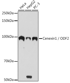 ODF2 Antibody in Western Blot (WB)