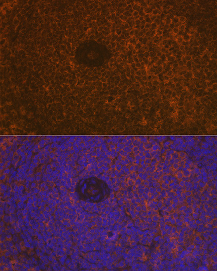 CD35 Antibody in Immunohistochemistry (Paraffin) (IHC (P))