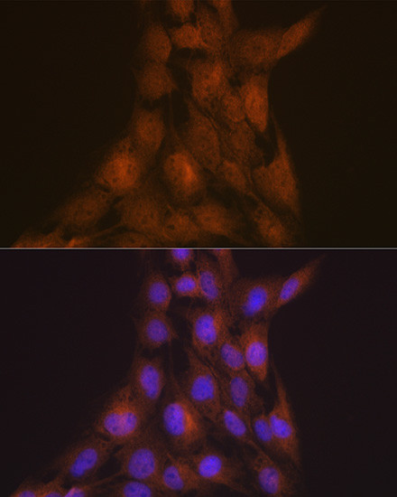 LIS1 Antibody in Immunocytochemistry (ICC/IF)