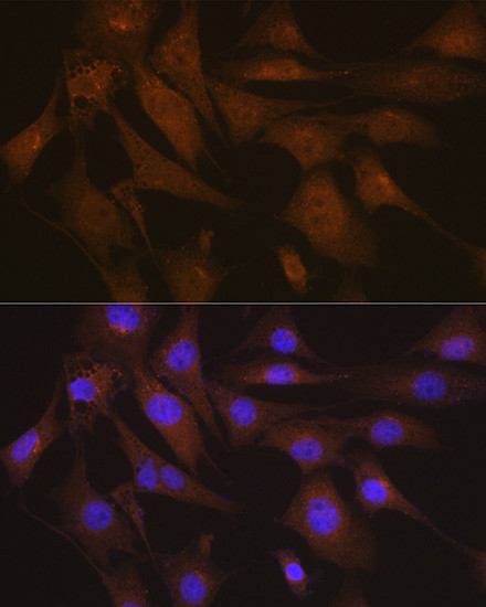 LIS1 Antibody in Immunocytochemistry (ICC/IF)