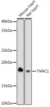 Cardiac Troponin C Antibody in Western Blot (WB)