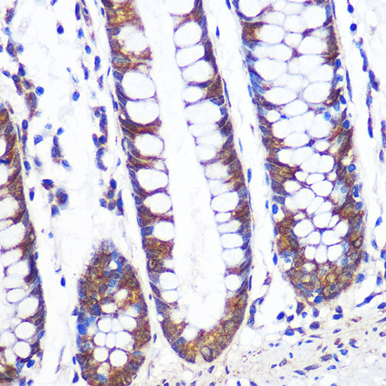 TCP1 Antibody in Immunohistochemistry (Paraffin) (IHC (P))