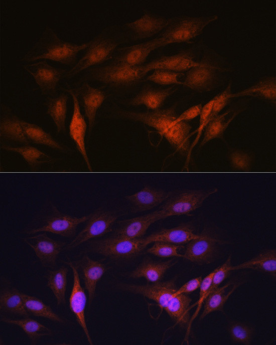 LXR alpha Antibody in Immunocytochemistry (ICC/IF)