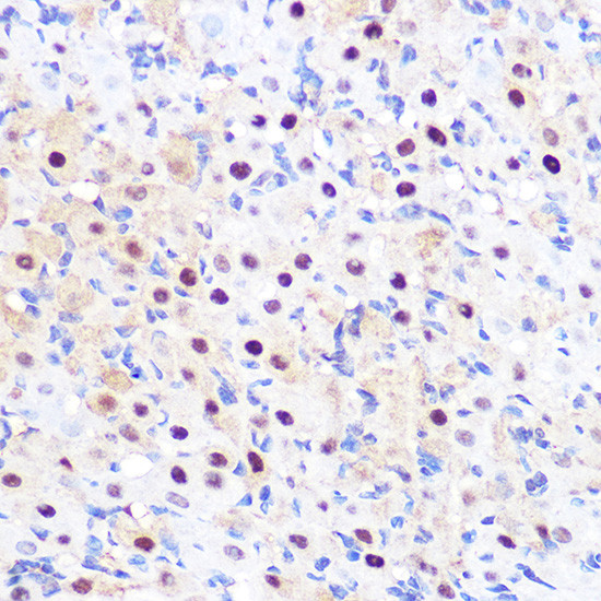 LXR alpha Antibody in Immunohistochemistry (Paraffin) (IHC (P))