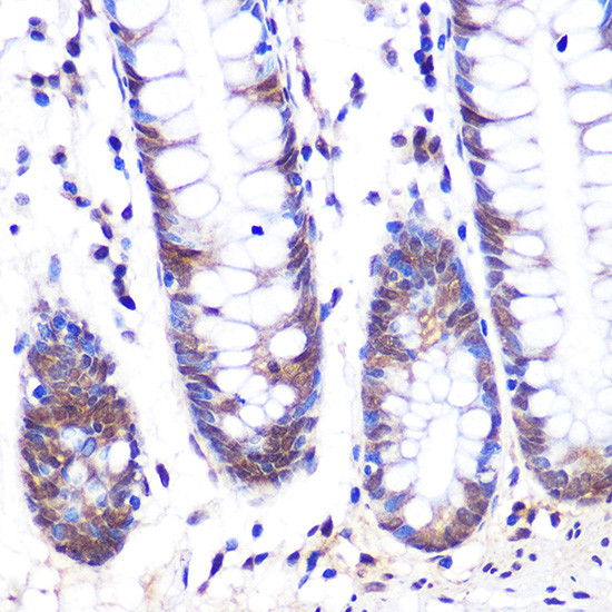 LXR alpha Antibody in Immunohistochemistry (Paraffin) (IHC (P))