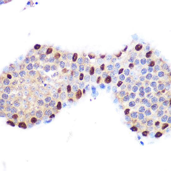 LXR alpha Antibody in Immunohistochemistry (Paraffin) (IHC (P))