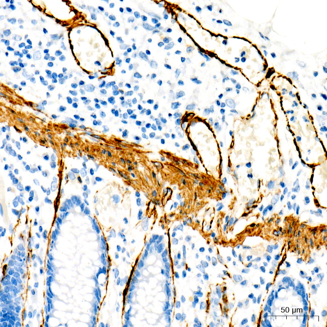 MYH11 Antibody in Immunohistochemistry (Paraffin) (IHC (P))