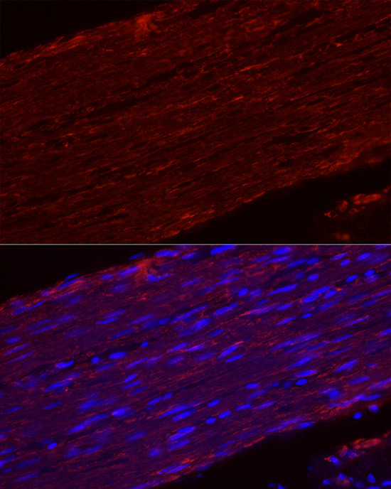 MYH11 Antibody in Immunohistochemistry (Paraffin) (IHC (P))