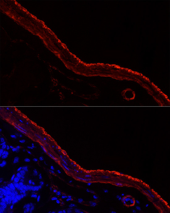 MYH11 Antibody in Immunohistochemistry (Paraffin) (IHC (P))