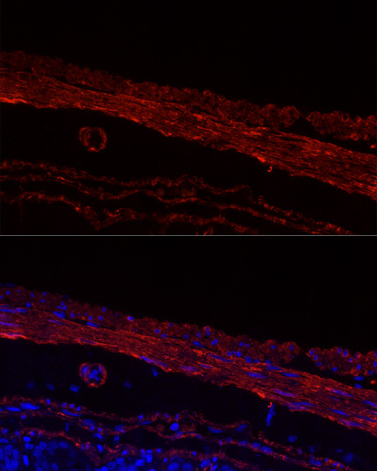 MYH11 Antibody in Immunohistochemistry (Paraffin) (IHC (P))