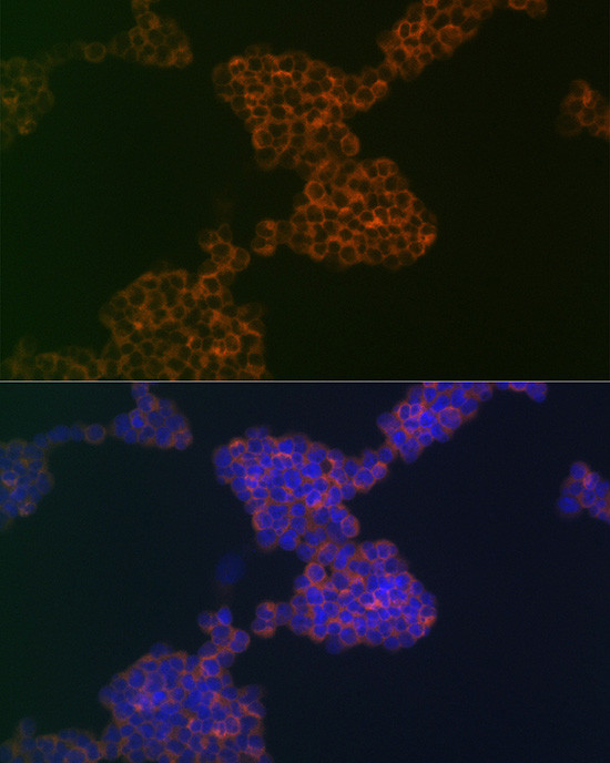 CD3g Antibody in Immunocytochemistry (ICC/IF)