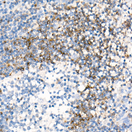 CD79b Antibody in Immunohistochemistry (Paraffin) (IHC (P))