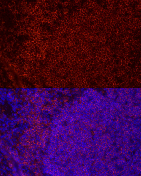 CD79b Antibody in Immunohistochemistry (Paraffin) (IHC (P))