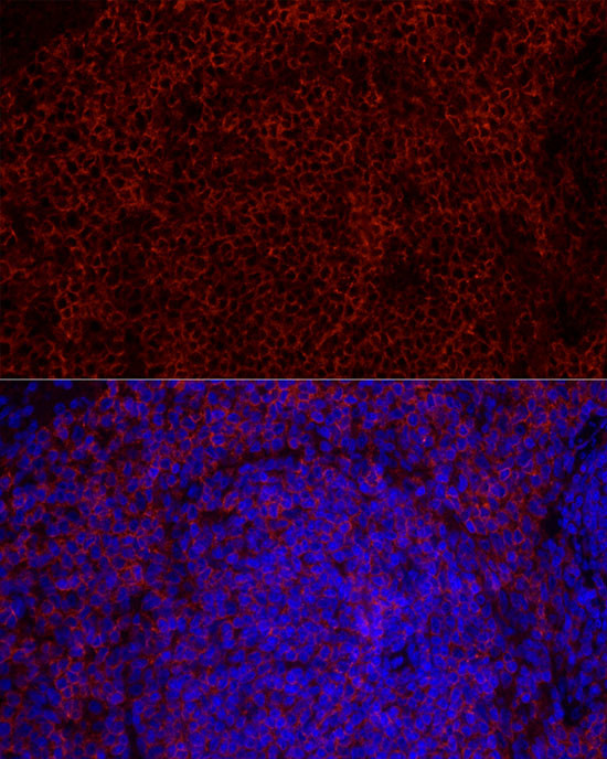 CD79b Antibody in Immunohistochemistry (Paraffin) (IHC (P))