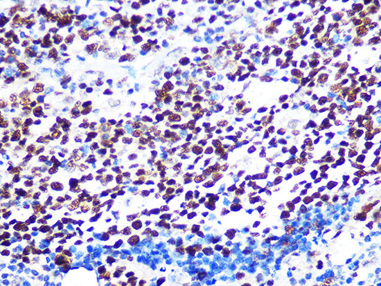 HAT1 Antibody in Immunohistochemistry (Paraffin) (IHC (P))